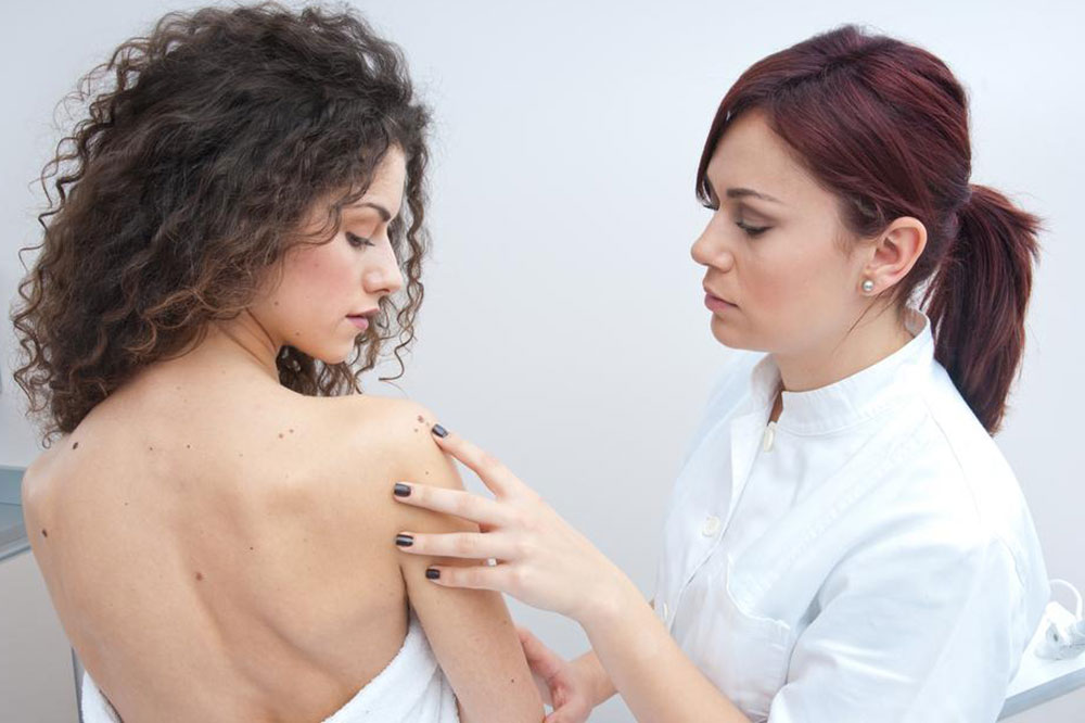 4 Lifestyle Changes to Manage Melanoma